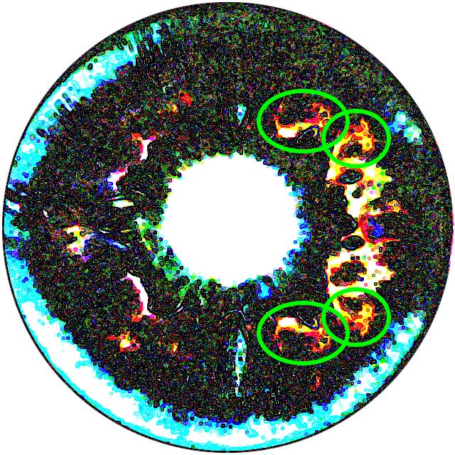 Fake Iris Detection